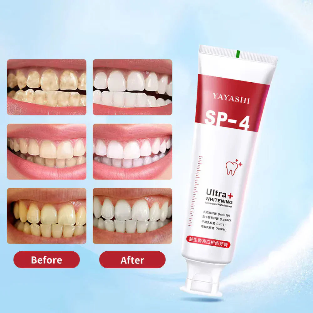 Yayashi SP4 Probiotic Whitening Toothpaste 120g – Removes Coffee, Tea & Smoking Stains